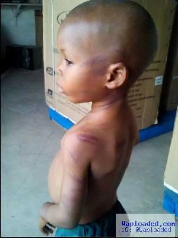 Photos-Teacher Beats 3 Year Old 